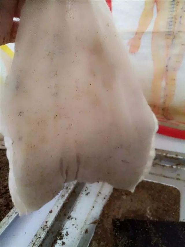 骨病保养小知识,如何预防骨病的十个动作