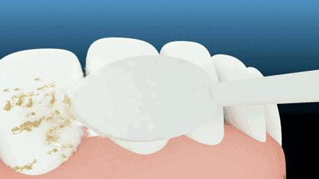 牙齿不好用什么牌子牙膏最好,牙齿超级不好用什么牙膏