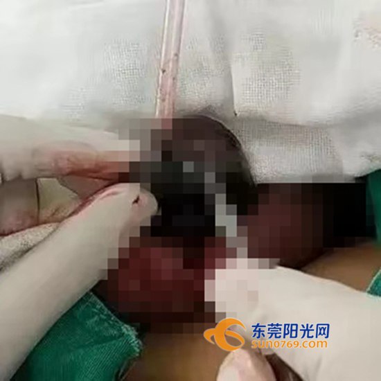 12岁小孩关节酸痛是什么原因,青少年出现身体各处疼痛