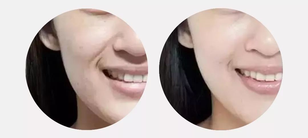 30-40岁抗皱紧致面膜推荐,蜜桃补水面膜儿童