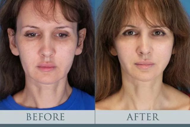 从“秃头症”到长发公主,听起来有点不可思议,但这是现实