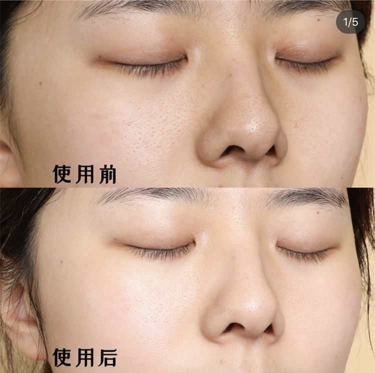 护肤小红书都在推荐的安瓶面膜,护肤补水推荐小红书