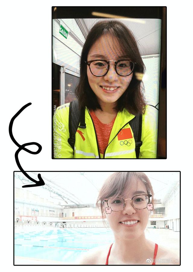 苏州老人补牙价目表,苏州口腔补牙齿多少钱一颗