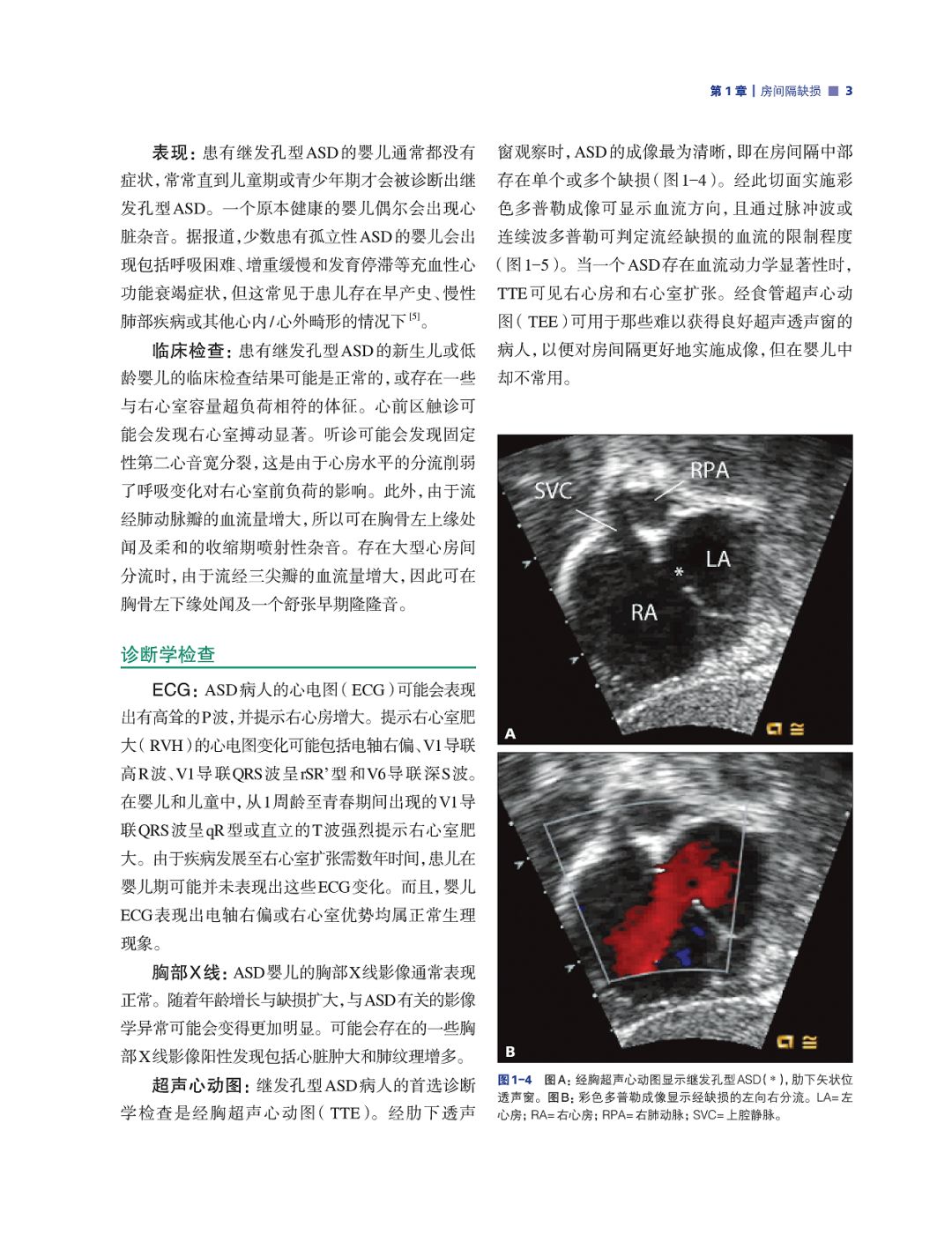 如何诊治先天性心脏病？看美国专家如是说