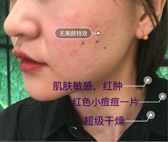 鍚冪硸闀跨棙鍙橀粦,鍚冪硸鍙橀粦闀跨棙