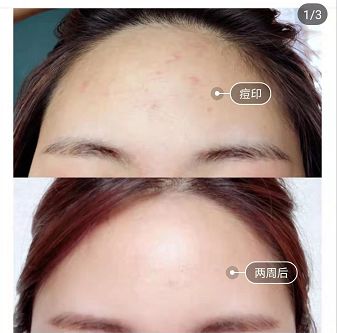 鍚冪硸闀跨棙鍙橀粦,鍚冪硸鍙橀粦闀跨棙