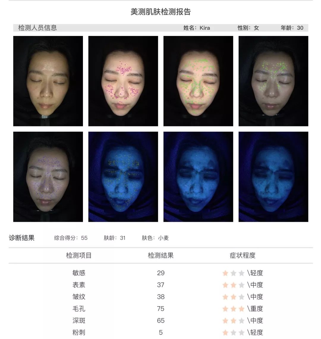 小茂肌诊室到底有多强,小茂肌诊室皮肤状态