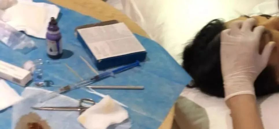 2女子在玉林做“微整形”被举报！事情背后竟藏着......