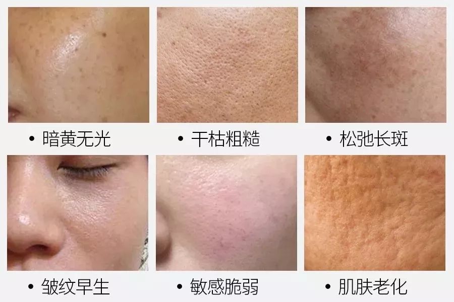 又一款神奇的“国货面膜”出现？这次轮到日本被种草了...