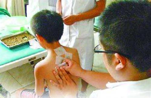 “三伏贴”正式开贴，到阜阳这些地方可体验“冬病夏治”