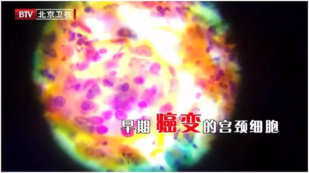 乳腺癌宫颈癌卵巢癌哪个死亡率高,乳腺癌患者容易得宫颈癌吗