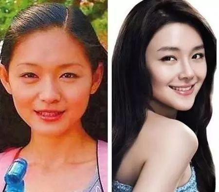 美白针出名的牌子,美白针品牌成分