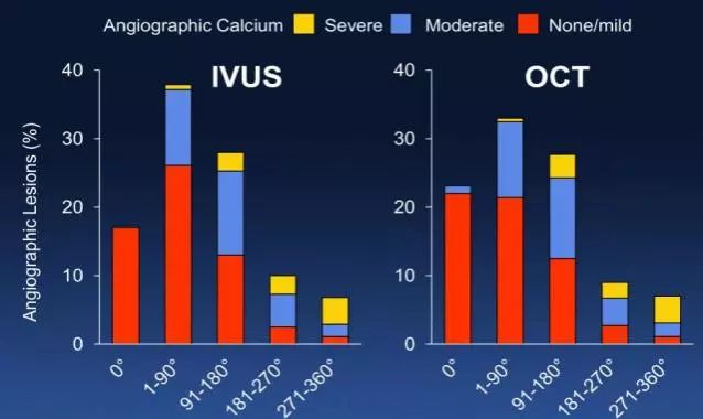 CIT2019｜李妍教授：OCT指导钙化病变，这些精髓要知道