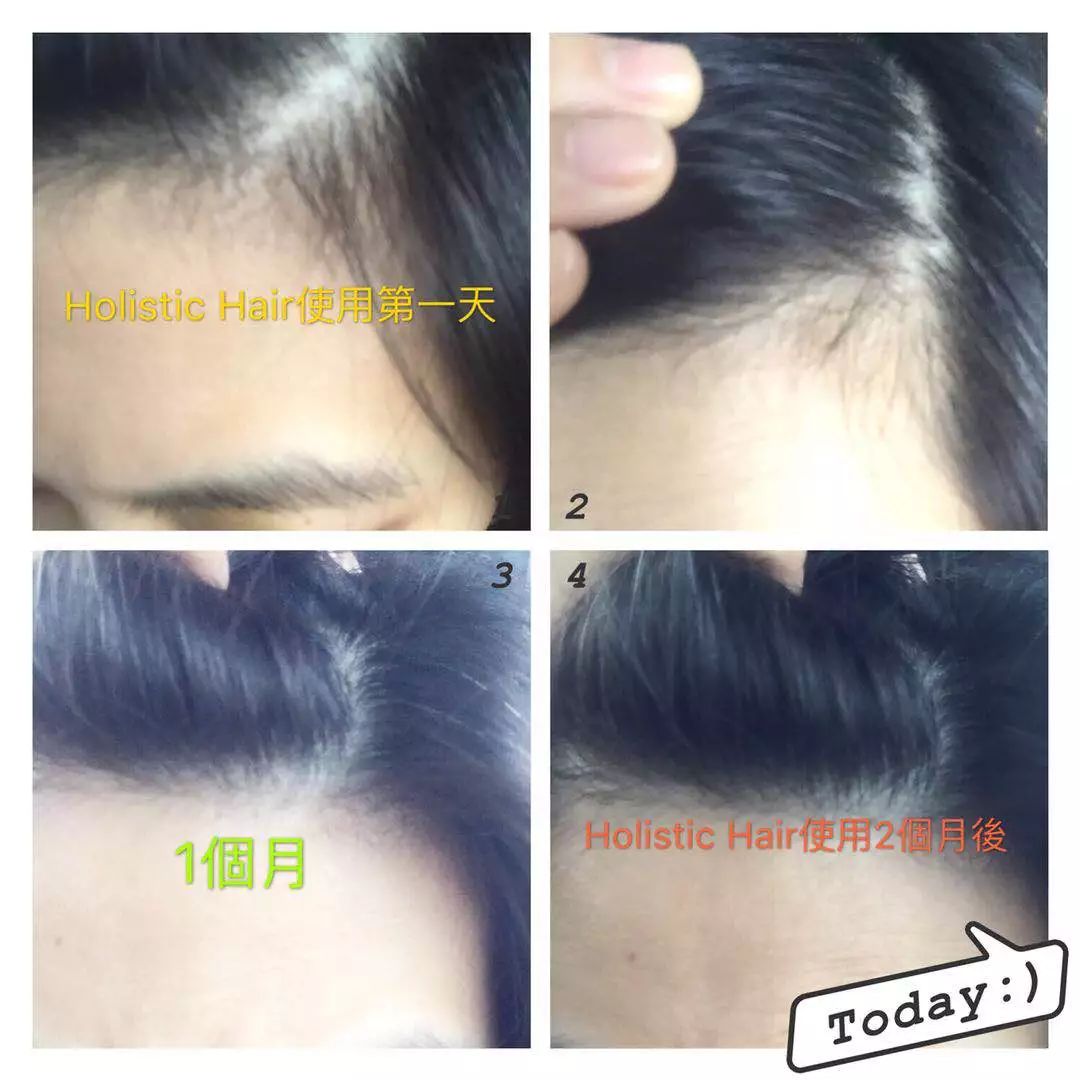 新西兰高端沙龙专用，2秒1喷，增发从“根”开始