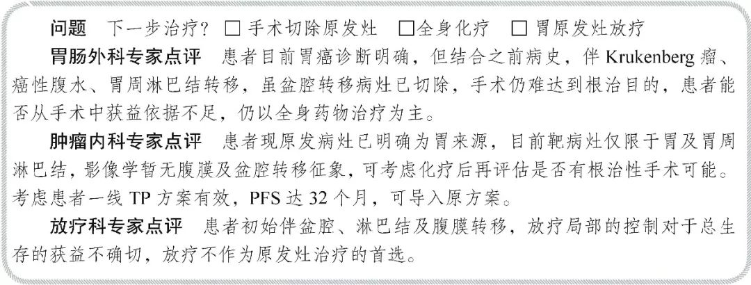 卵巢恶性肿瘤伴腹膜多发转移,原发卵巢癌伴腹膜多发转移