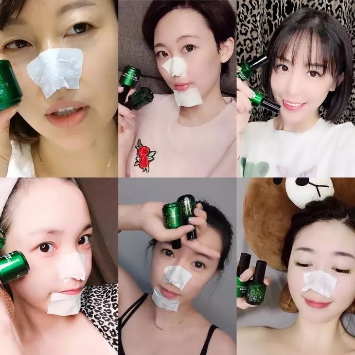 清洁毛孔|又爽又恶心的去黑头方法来了！5分钟将你10年的黑头白头连根拔起