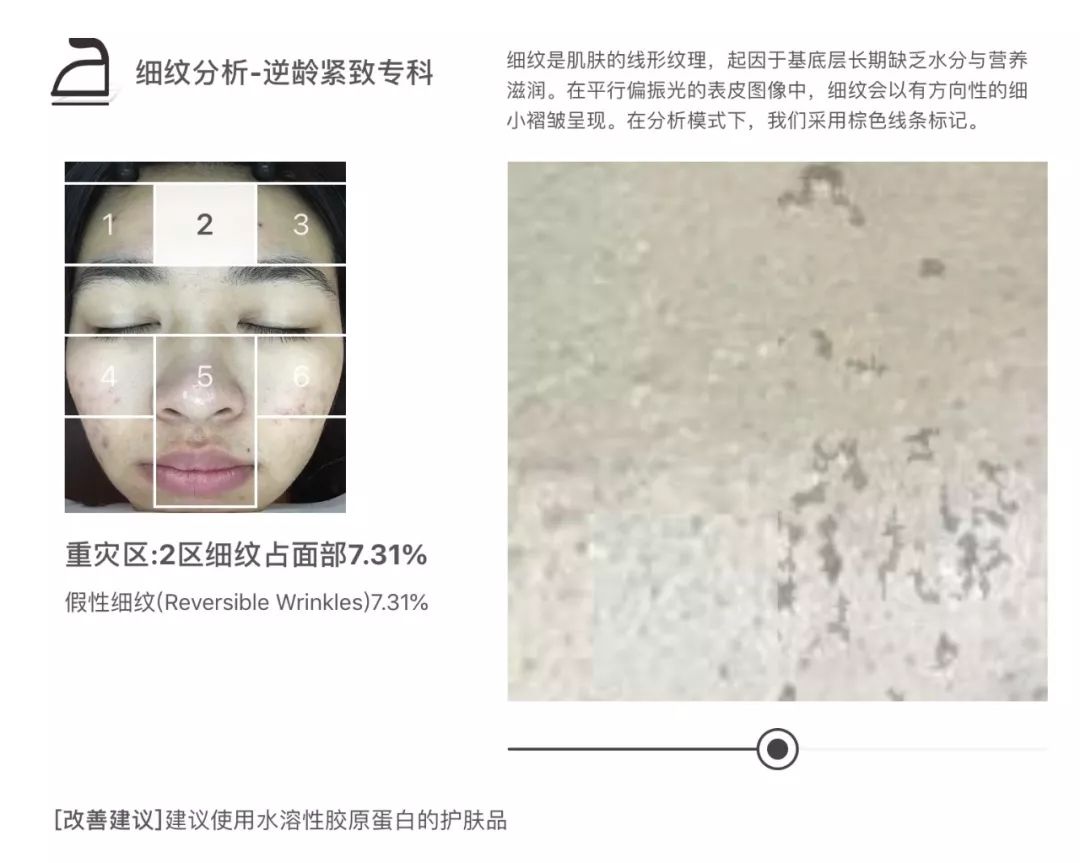 灏忚寕鑲岃瘖瀹よˉ姘村悧,灏忚寕鑲岃瘖瀹ゅ埌搴曟湁澶氬己