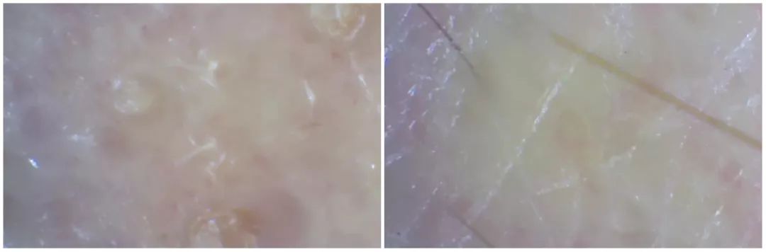 灏忚寕鑲岃瘖瀹ゅ埌搴曟湁澶氬己,灏忚寕鑲岃瘖瀹よˉ姘村悧