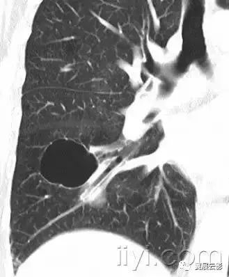胸部解剖及常见疾病影像表现,胸部影像学基础知识