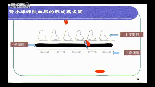 科普肾脏,医学科普出汗和肾脏关系