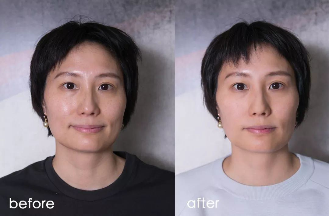 小茂肌诊室∣为什么拼命补水好多年,皮肤还是没变好?