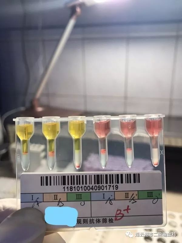 吓坏了的婴儿,b型血和o型血的宝宝会溶血吗