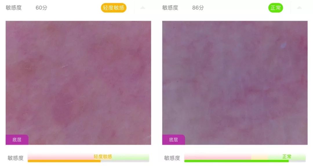 盲测14天揭密|年轻肌特训营收关，那瓶好评如潮的精华水究竟是谁？