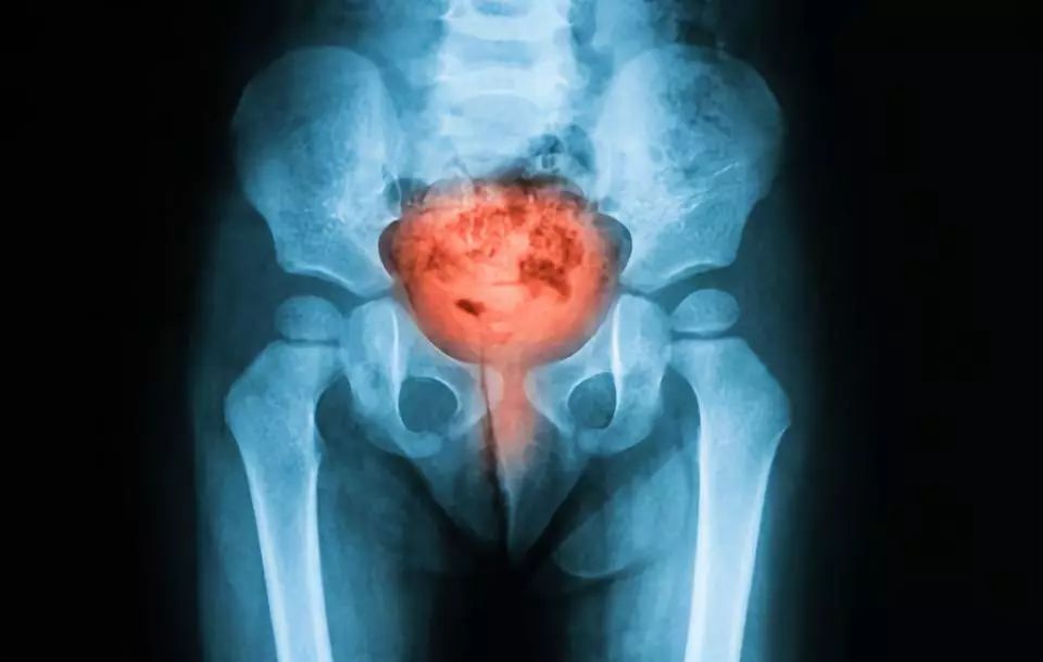 半夜被尿憋醒还出汗怎么回事,半夜4点多被尿憋醒后睡不着了