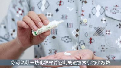 要你好看|听过很多祛痘方法,却还是收拾不了“车祸脸”?