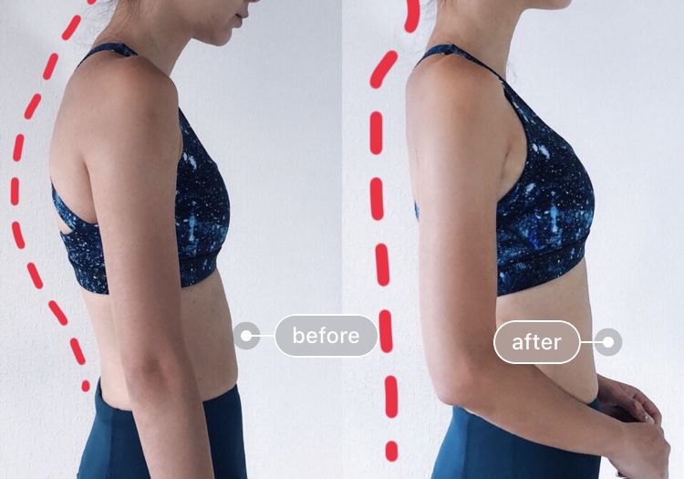 有什么方法可以改善含胸驼背,含胸驼背改善的方法