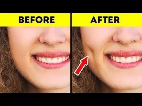 这届年轻人到底想要什么,为什么现在年轻人都想整容