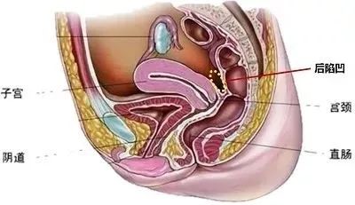 这几种妇科病其实根本不用治,妇科病怎样才可以完全治愈