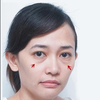 解决眼袋只需3步,不管眼袋多严重用点它