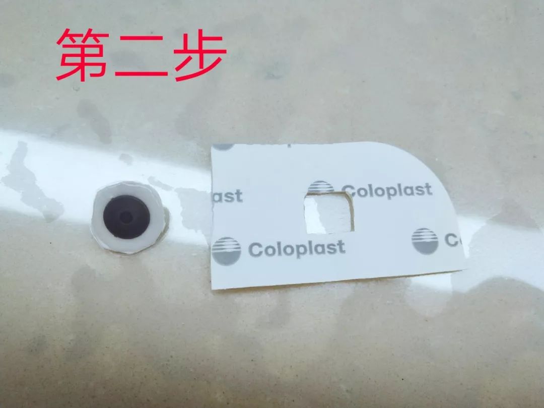 电极片皮试过敏,电极贴过敏的整改措施