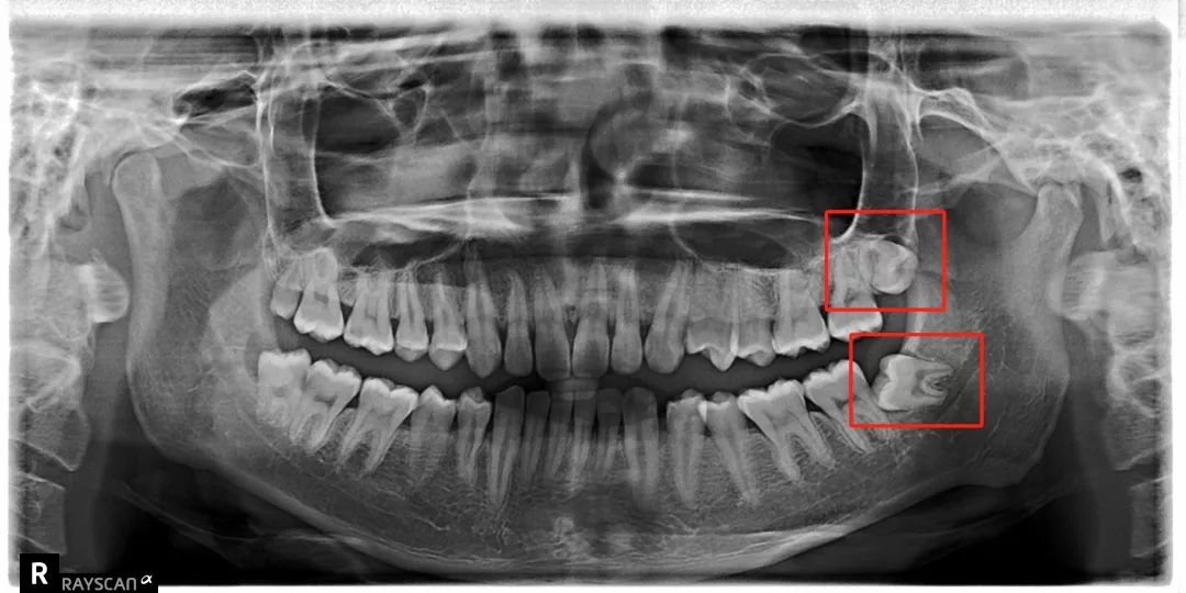 漫画科普牙科,小学生漫画科学护牙