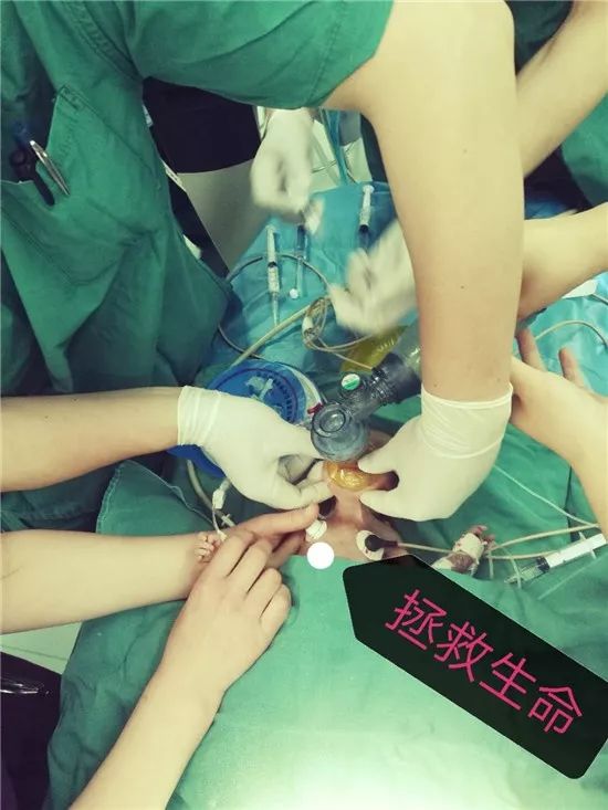 奇迹！日照一名2斤2两早产儿成功获救！