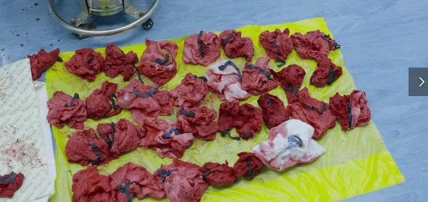 angelababy3岁到30岁,angelababy是否自己生娃