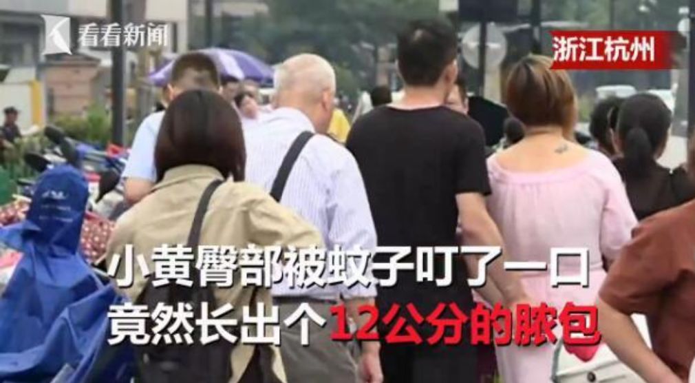 泰国蚊子咬止痒膏,防蚊虫叮咬药膏推荐泰国