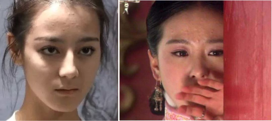 灰头土脸怎么改善,灰头土脸怎么预防