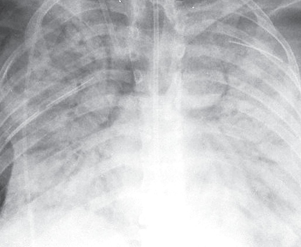 认识肺部的目的,认识呼吸器官知识点