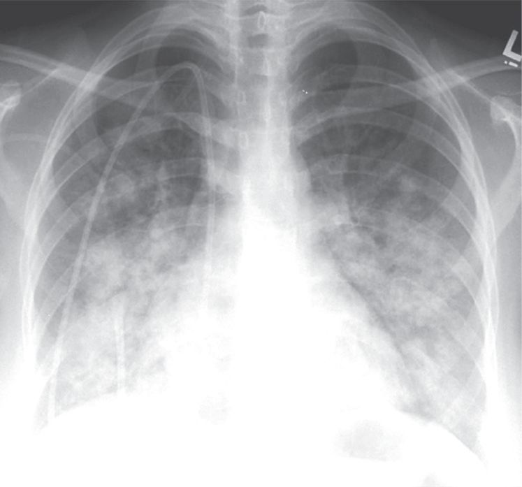 认识肺部的目的,认识呼吸器官知识点