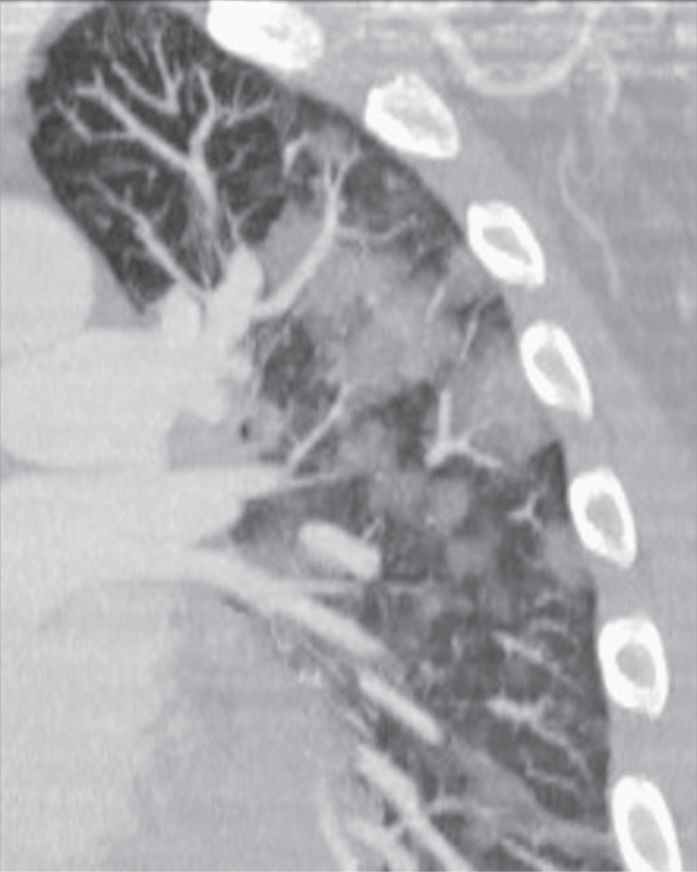认识肺部的目的,认识呼吸器官知识点