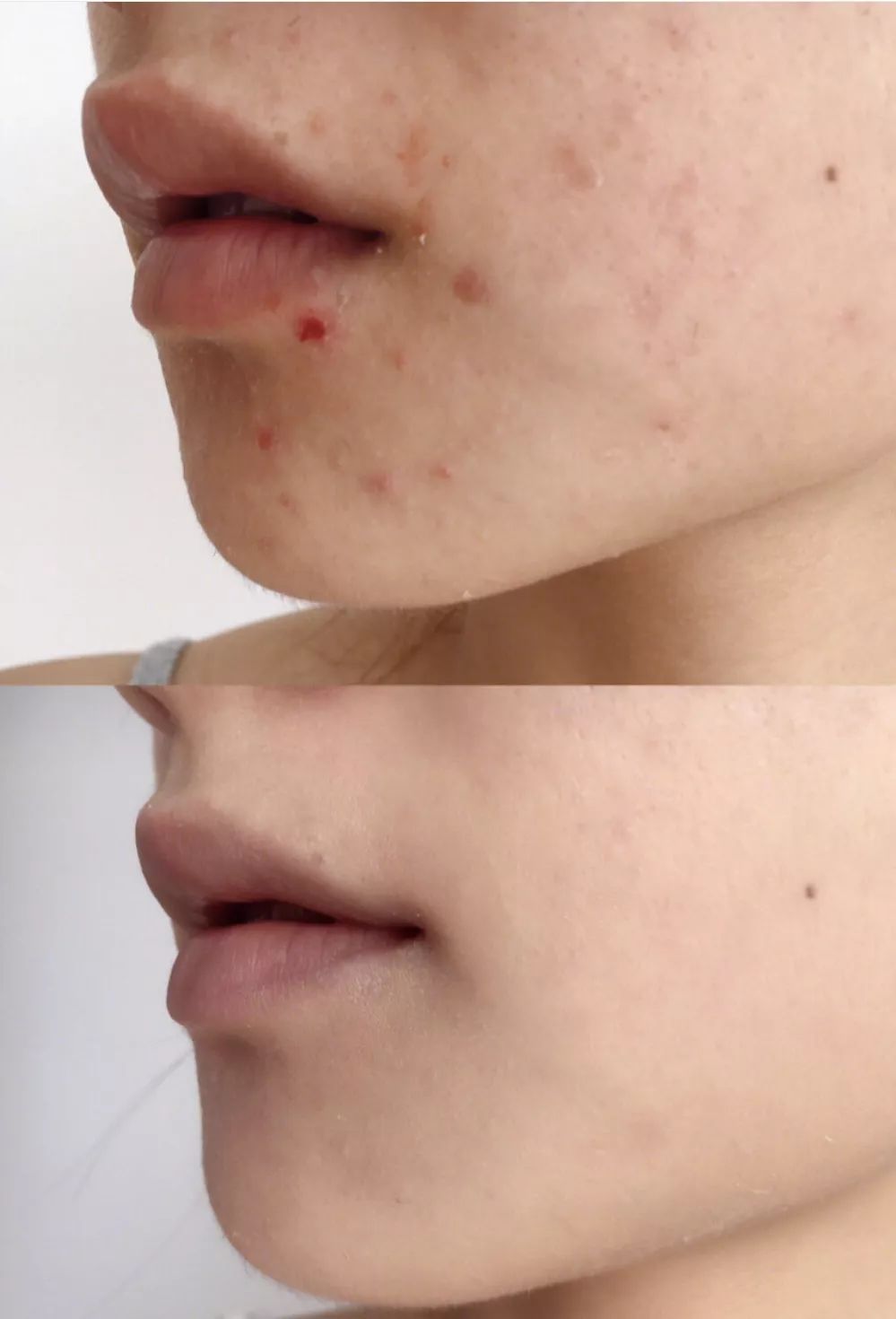 有必要用哪一款水乳,一辈子就能用一套水乳