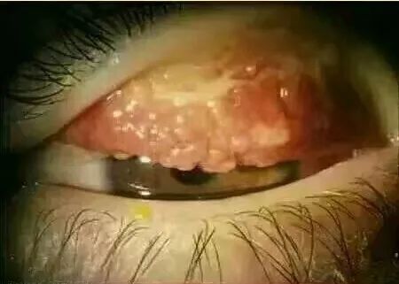 “日本制造”又曝丑闻!违禁成分泛滥,却还有1亿中国人疯抢