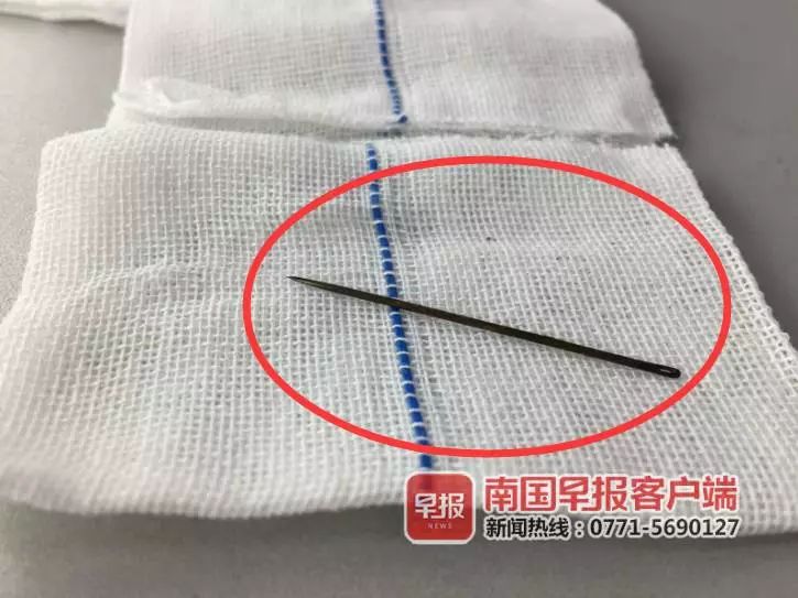 看着就很痛！广西一男孩竟将4.5厘米长缝衣针塞入*体下**…