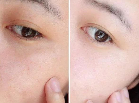 维c美白提亮推荐,抗皱维c