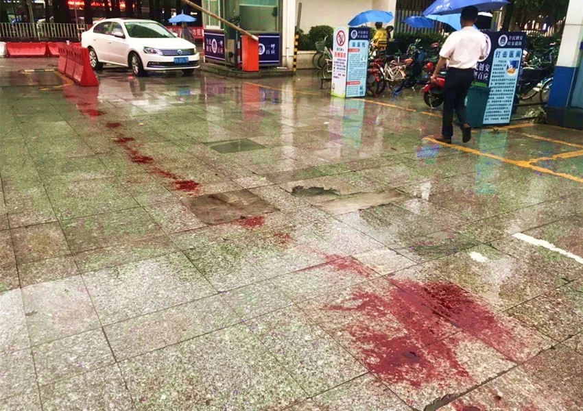 装修工失手割断动、静脉失血超3000毫升东莞“硬核”医生将其救回