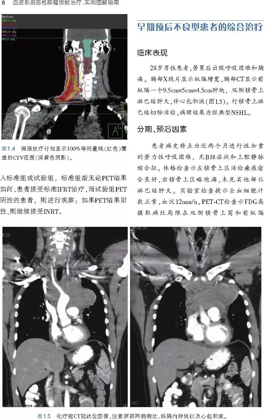 血液系统恶性肿瘤放射治疗：实用图解指南