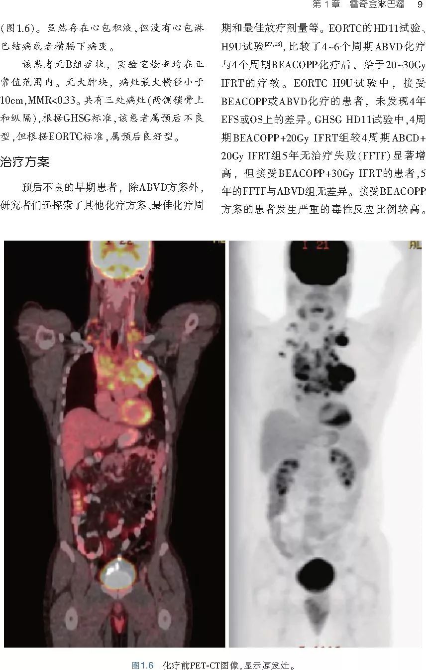 血液系统恶性肿瘤放射治疗：实用图解指南