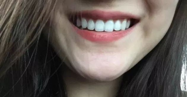 好物丨用它30秒吐掉嘴里所有脏东西,连呼吸都是水果味